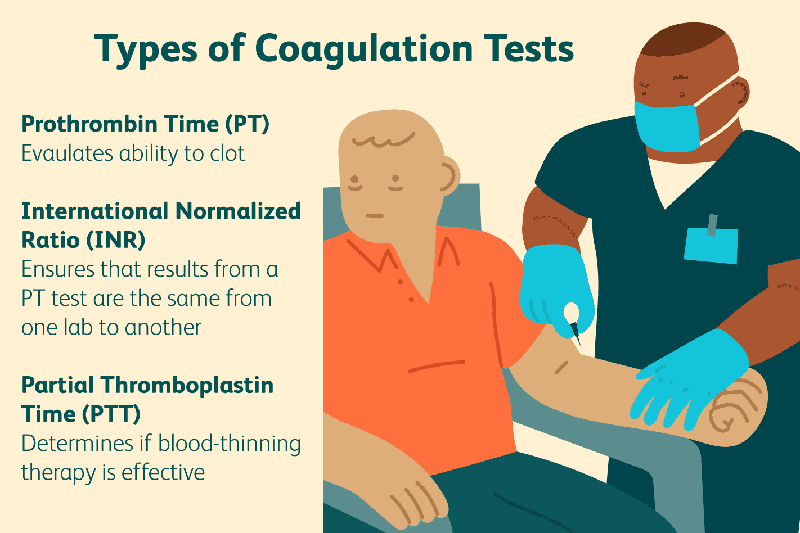 Xét nghiệm INR là xét nghiệm gì? Có quan trọng không?