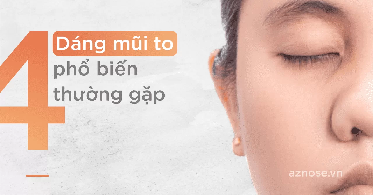 4 Dáng mũi to phổ biến thường gặp