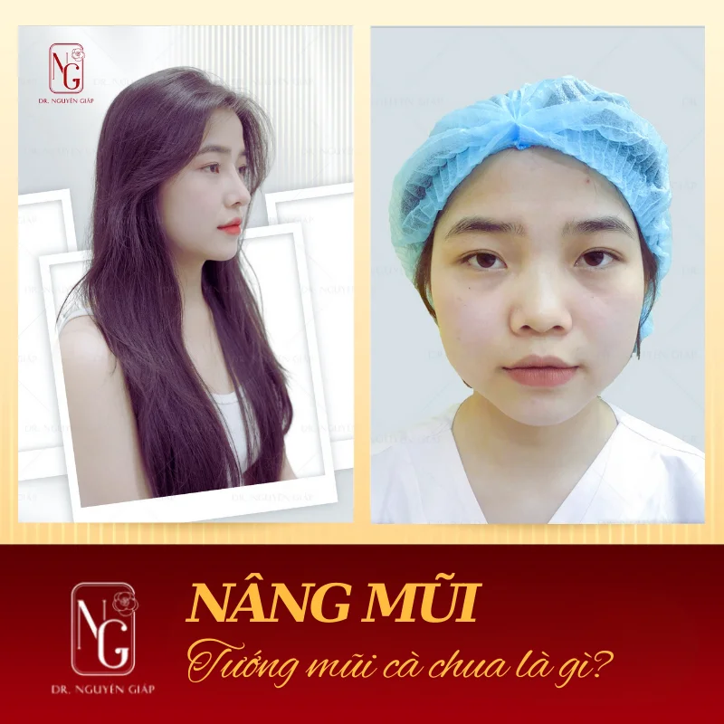 Tướng Mũi Cà Chua Là Gì? Ý Nghĩa Tướng Số Và Cách Cải Thiện