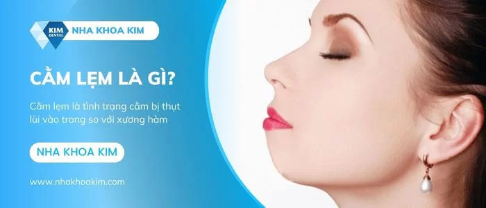 Cằm lẹm là gì? Căm lẹm niềng răng có hết không?