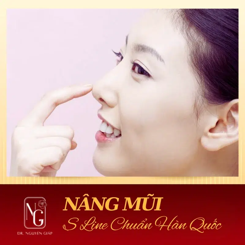 Nâng mũi S-line Hàn Quốc