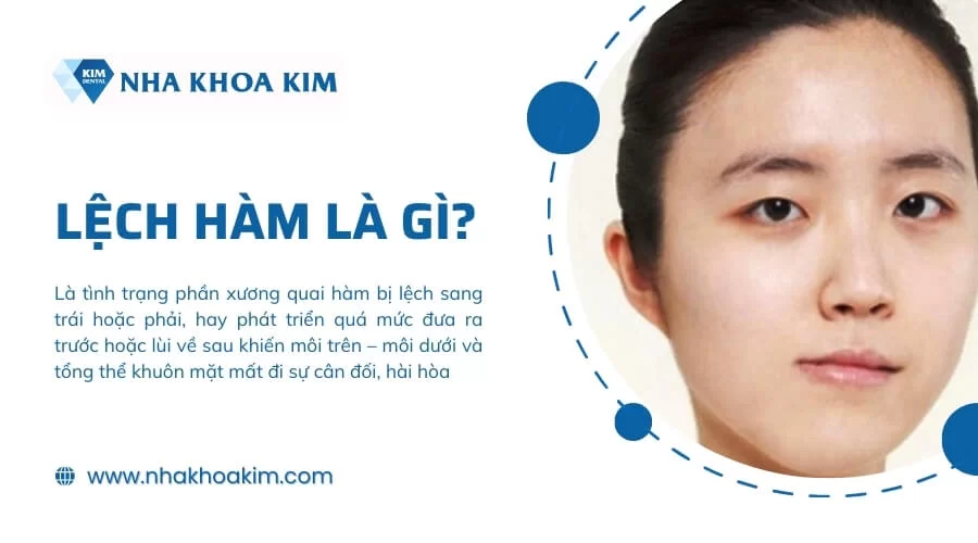 Hàm lệch là gì? Điều trị bằng cách nào cho gương mặt đẹp cân đối?