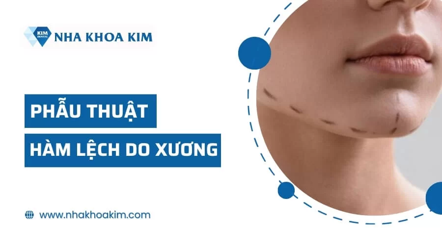 Hàm lệch là gì? Điều trị bằng cách nào cho gương mặt đẹp cân đối?