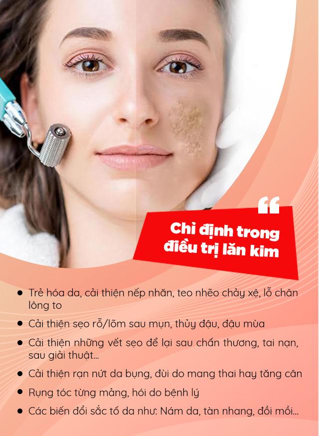 Tưởng da căng mịn sau lăn kim, cô gái gây sốc toàn tập với khuôn mặt chi chít mụn mảng