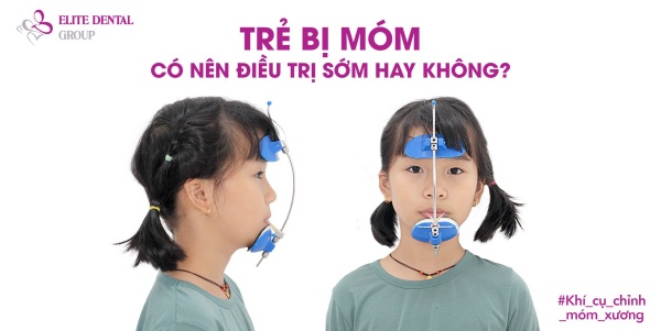 Răng móm là gì? Nguyên nhân, dấu hiệu và cách khắc phục