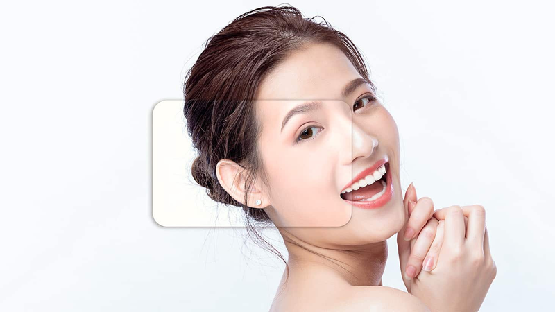 Căng chỉ collagen có tốt không? Phương pháp căng chỉ collagen có ưu điểm gì?