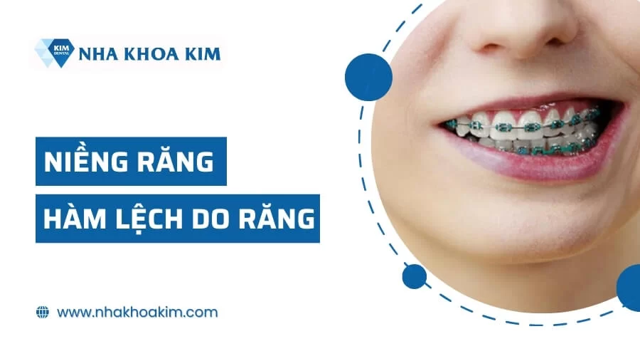 Hàm lệch là gì? Điều trị bằng cách nào cho gương mặt đẹp cân đối?