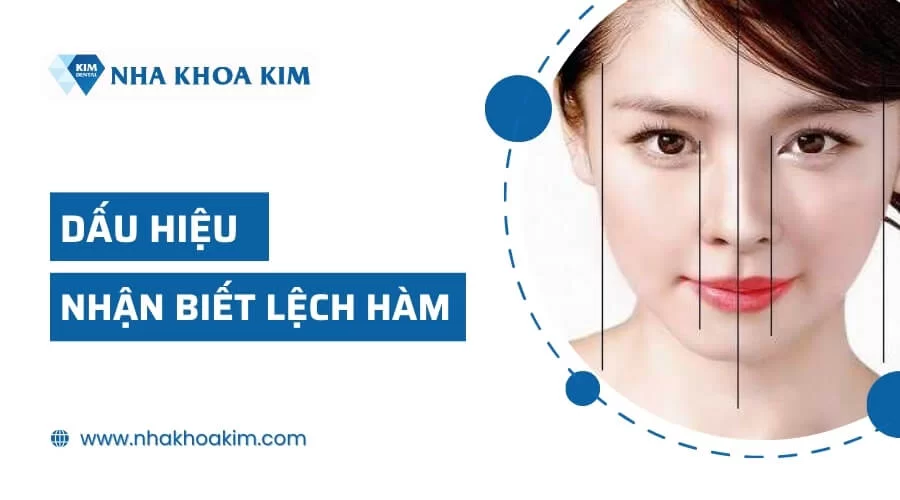 Hàm lệch là gì? Điều trị bằng cách nào cho gương mặt đẹp cân đối?