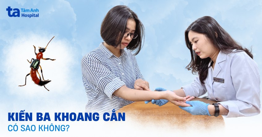 Bị kiến ba khoang cắn có sao không? Nên làm gì cho tốt?